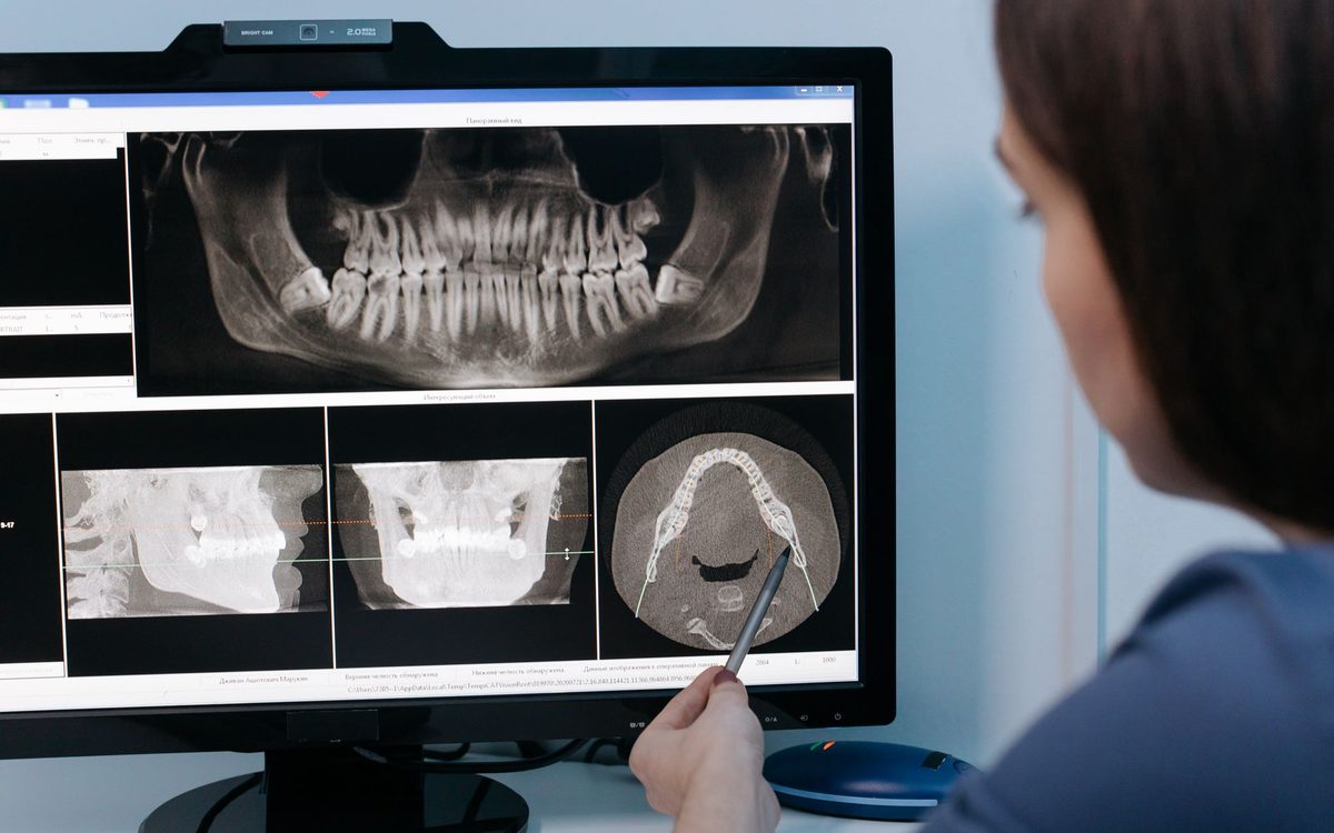 Radiographie panoramique de la mâchoire analysée à l'écran
